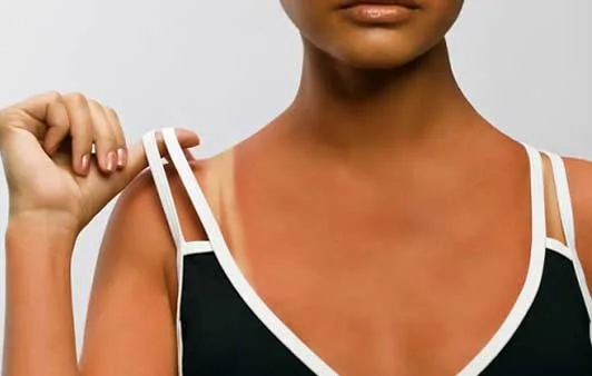 Vuoi un’abbronzatura perfetta? Non commettere questi errori!