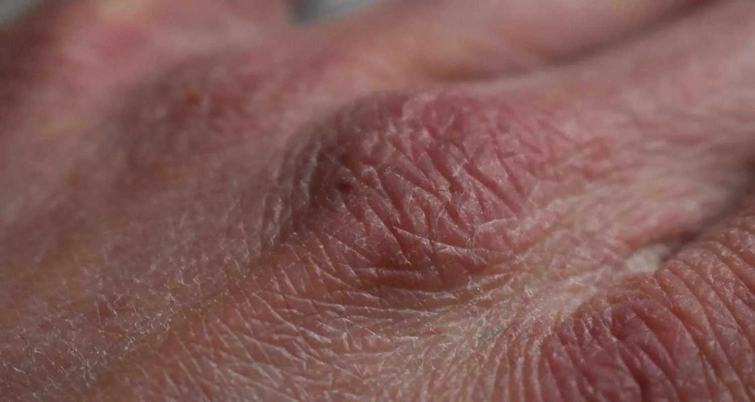 Il miglior sistema per curare la pelle secca
