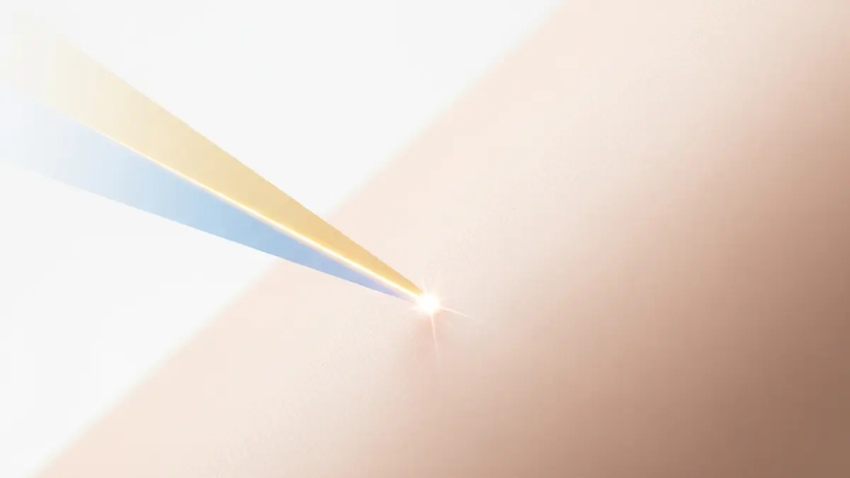 Laser e Peli Incarniti: La Soluzione Definitiva per una Pelle Liscia